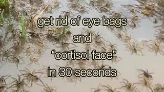 How to Get Rid of Eye Bags, &lsquo;Cortisol Face&rsquo; and Headaches in 30 Seconds
