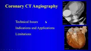 10b Coronary CT Angiography Technique