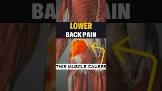 ‼️ This muscle is probably causing you lower back pain