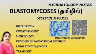 Blastomycoses / Blastomyces dermatitidis / Systemic mycoses / Dr. Blessy / TAMIL /Microbiology notes