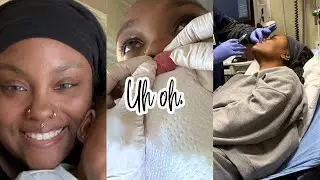 getting my embedded medusa piercing removed 😳