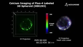 CHEETAH™ application _ Calcium Imaging of Fluo-4 labeled 3D Spheroid (HEK293) 10 volumes per second