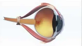 New technology aiding in AMD damaged retina to enter clinical trials in 2013