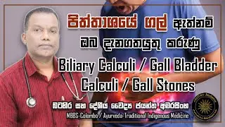 පිත්තාශයේ ගල් ඇත්නම් ඔබ දැනගතයුතු කරුණු | Biliary Calculi / Gall Bladder Calculi / Gall Stones