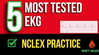 5 Most Tested EKG Rhythms on NCLEX: Cardiac Strips Practice Questions + Answers