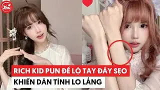 Rich kid Pun để lộ tay đầy sẹo khiến d&acirc;n t&igrave;nh lo lắng #punpun