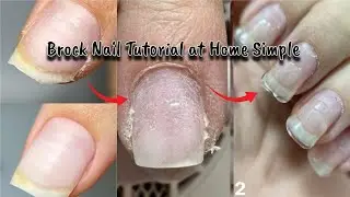 How to Fixing Broke Nail Tutorial at Home (Simple 2 Minutes)