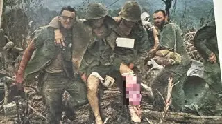Vietnam&rsquo;s Most PAINFUL Jungle Infections U.S  Soldiers Developed in the Field