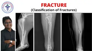 FRACTURE (Classification) | Lecture 02 I Orthopedics