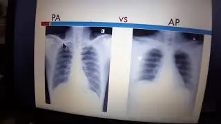 VIVA questions regarding X-ray film