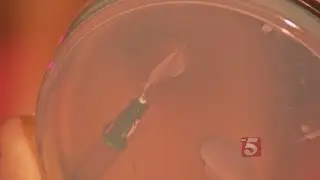 Limb Transplant Gel Could Save Hands, Feet & Faces