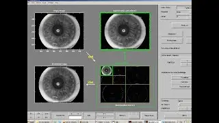 Hybrid robust iris recognition, two-dimensional gabor features, multi-layer, neural network, PSO