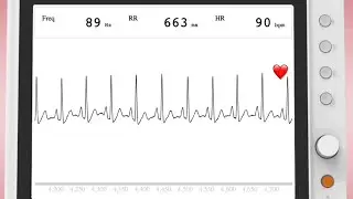 How I created an ECG monitor for $10