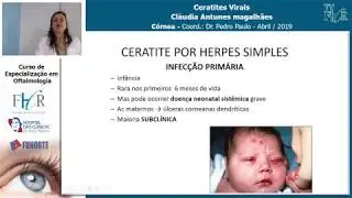 Ceratites Virais - Cl&aacute;udia Antunes -  C&oacute;rnea