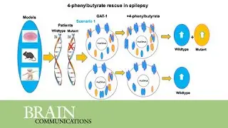 PBA restored GABA uptake and reduced seizures in SLC6A1 patient variant-bearing cell & mouse models