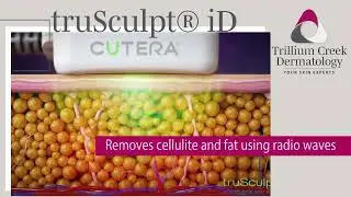 truSculpt&reg; iD at Trillium Creek Dermatology