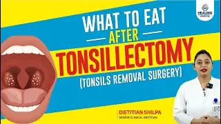Expert's Diet Plan After Tonsil Removal Surgery: What to Eat and&nbsp;What&nbsp;to&nbsp;Avoid