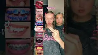 Krististar teeth #kristi #Innkastar #tiktok
