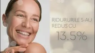 Altrient C - Cel mai bun supliment pentru frumusete