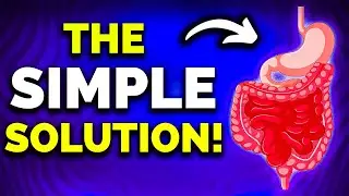 Dietitian Explains How to Stop Binge Eating if You Have IBS