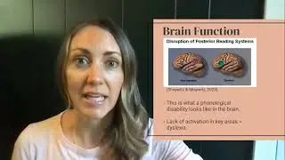 Dyslexia in the Elementary Years--The Science of Dyslexia