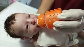 Laproctomy patient feeding time cute baby ♥️