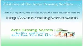 Dead sea mud - Acne treatment