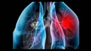 houston asbestos lawyer