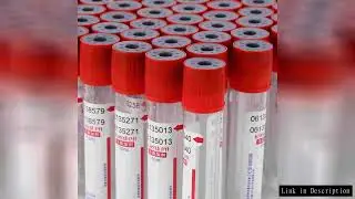 100 Pcs Disposable Glass Blood Collection Vacuum Tubes With Negative Pressure Lids Test Tube Cover T