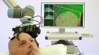 TMS Robotizada - Localite & Magventure & Axilum Robotics