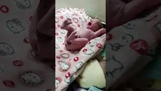 new born twins baby 😄🍼