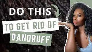 Best ways to get rid of dandruff | Seborrheic Dermatitis Treatment