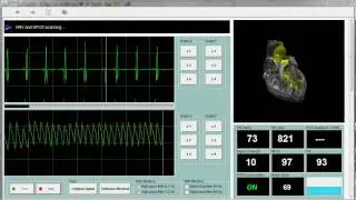 Monitoring Cases using EIS