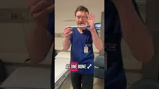 How to reduce a fracture in emergency. Need to worsen it first in order to win the battle v geometry