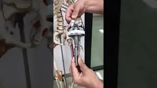 HRSK Hinged Knee System produced by JUST Medical.