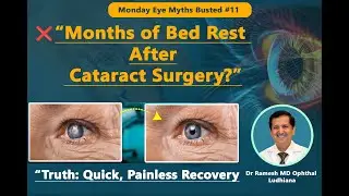 Myth Busted #11| Cataract Surgery & Bed Rest | Painless Quick Recovery &ndash; Dr Ramesh MD (Eyes)Ludhiana