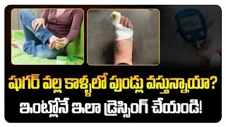 Diabetic Foot Ulcer Dressing at Home | Diabetic Foot Ulcer Treatment in Telugu | Diabetic Foot Care