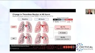 Critical Advancements: Evolving Data and Technology for Advanced Treatment of Pulmonary Embolism