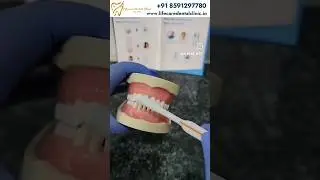 Check Out How to Brush Properly - Life Care Dental Clinic
