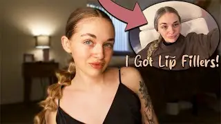 GRWM | Opening up about my lip injections
