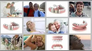 Neoss&reg; Patient Video