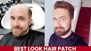 Hair Patch for Men in Patna | Wig in Patna #hairpatch #hairwig #hairstyle