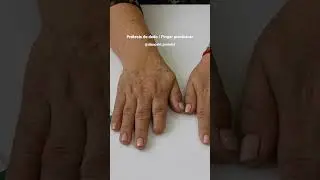 Pr&oacute;tesis est&eacute;tica de dedo 👆🏻/ Aesthetic finger prosthesis #protesis #prosthetics #viral #finger