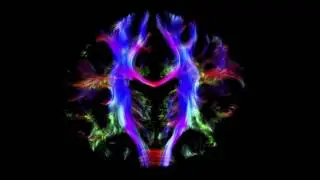 Skorpion878 (Tryom) - Alive