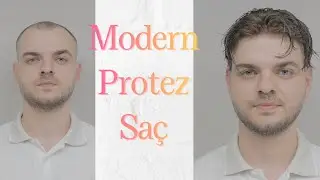PROTEZ SA&Ccedil; UYGULAMASI - Hair Replacement
