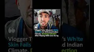 White Skin Reacts ☀️#TylerOliveira #WhiteSkin #IndianClimate #Vlogger #SkinInfection