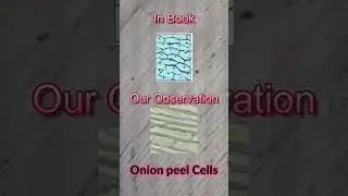 Cells Under Microscope (Ovum Cells, Muscle Cells, Onion Peel Cells, and Blood Cells) | LP