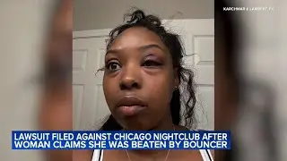 River North club bouncer beat woman for no reason: lawsuit