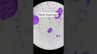 The Groundbreaking Discovery of Human Stem Cells | This Day in History: 25th JULY
