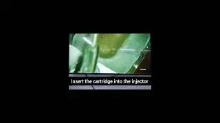 Foldable IOL insertion | Demonstration 👁️
